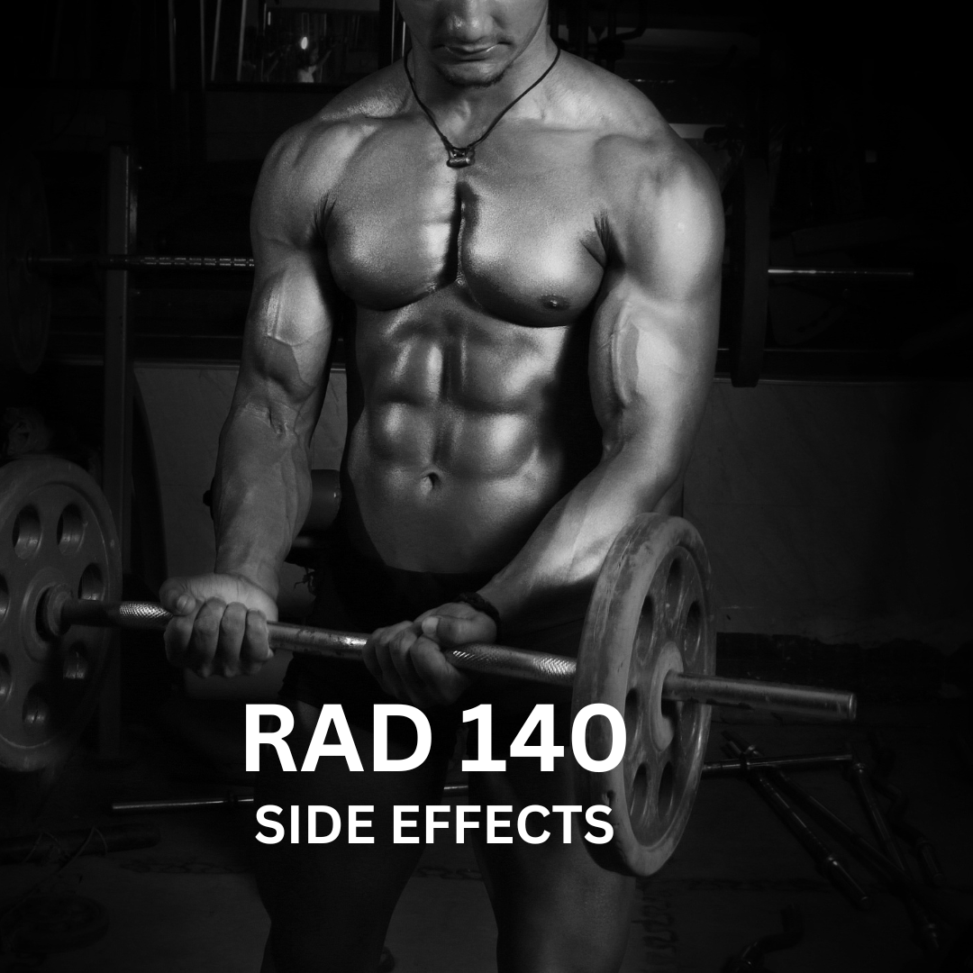 rad 140